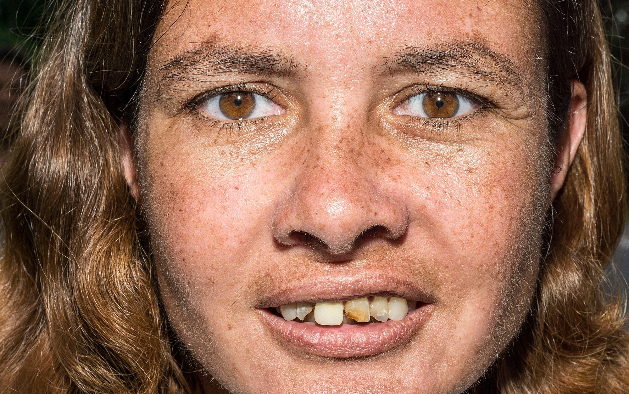 There Is No Shame Worse Than Poor Teeth In A Rich World Aeon Essays